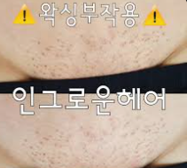 왁스스트립
